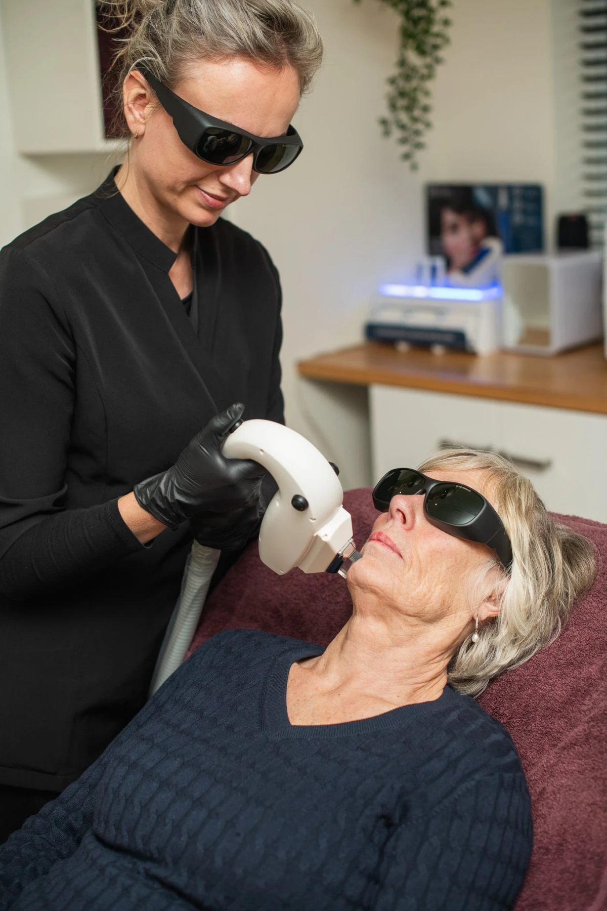 IPL huidverjonging limmen